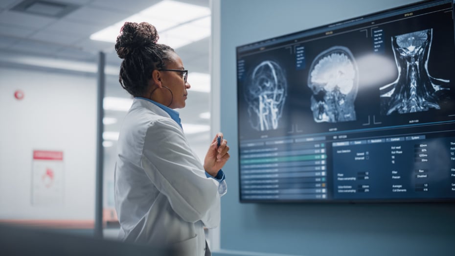 Female doctor looking at brain scans MRI